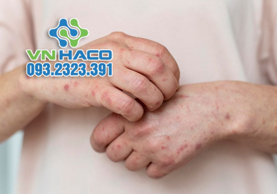 formaldehyde co trong san pham nao